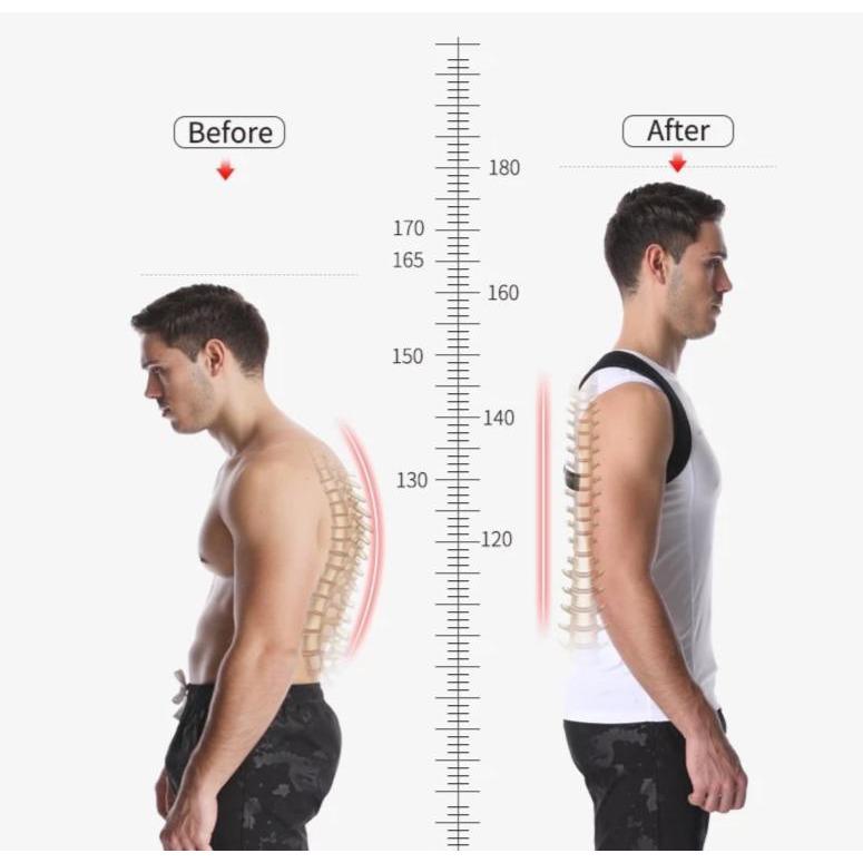 Optimal Posture Corrector - OptimalBack