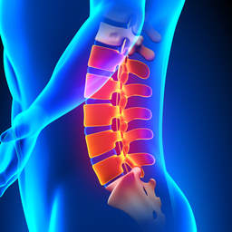 Spondylolisthesis: Causes, Symptoms, and Treatment Options