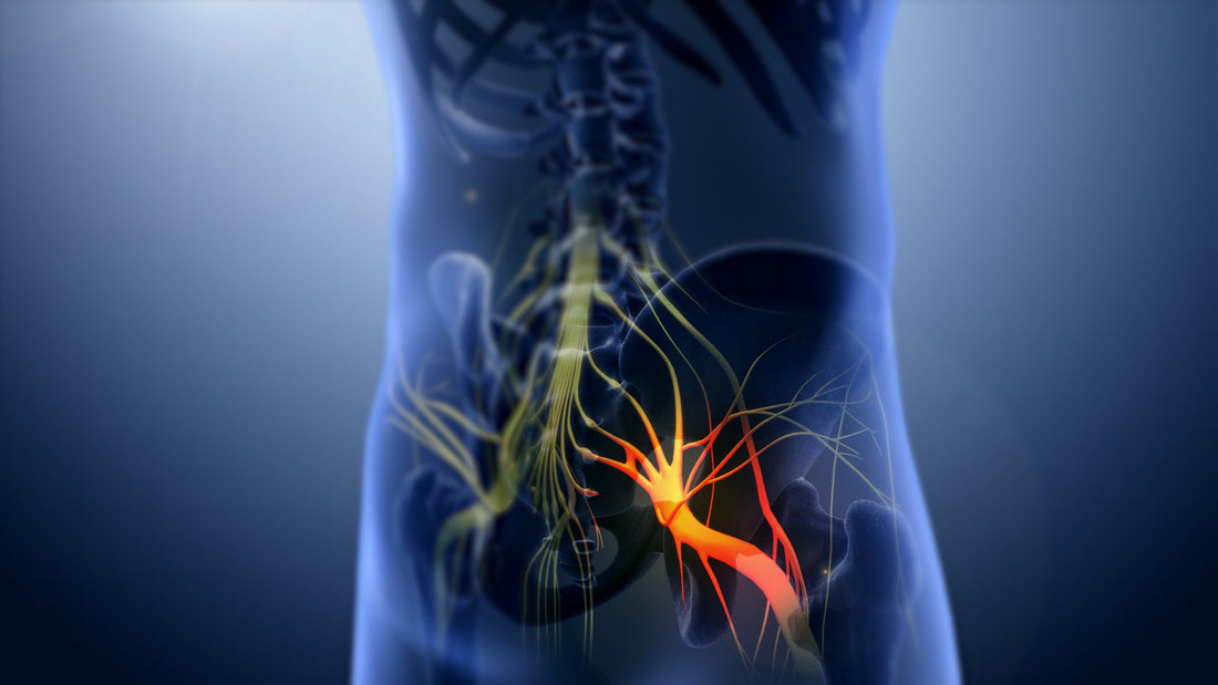 Sciatica Nerve Pain Relief - OptimalBack